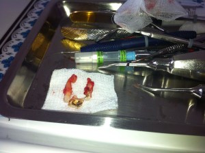 We are going to need a bigger Tooth Fairy!